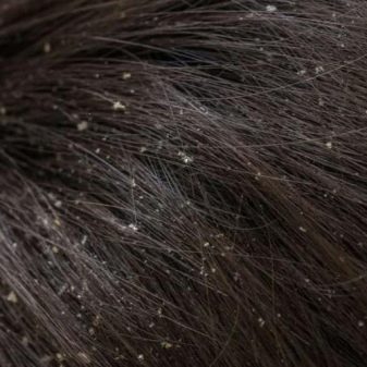 Хімія на довге волосся (61 фото): як зробити дрібну хімічну завивку тонкого волосся? Види хімії і способи виконання