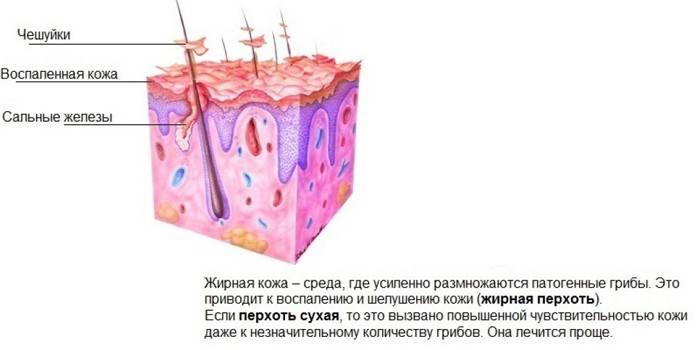 15 кращих шампунів від лупи, які позбавлять від проблеми назавжди