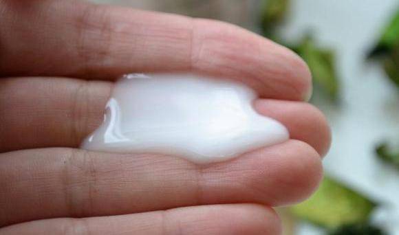 Білі виділення у жінок