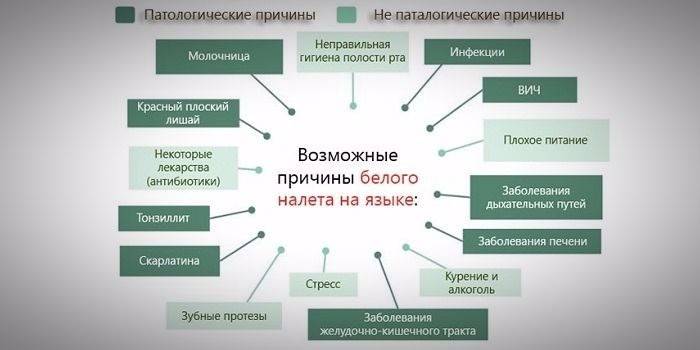 Білий наліт у горлі у дитини або дорослого — причини появи, засоби терапії