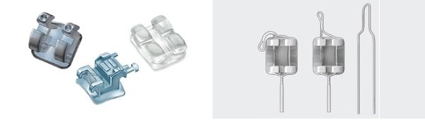 Ціни брекетів на зуби