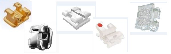 Ціни брекетів на зуби Ціни брекетів на зуби