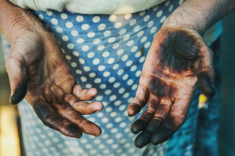 Чем можно отмыть руки после грибов маслят