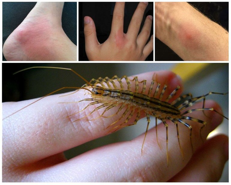 Чем опасна для людей мухоловка и как избавиться от насекомого Чем опасна для людей мухоловка и как избавиться от насекомого