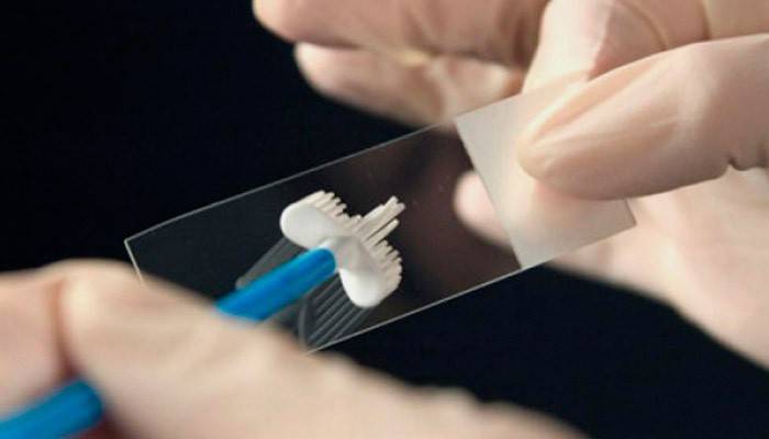 Епітелій в мазку