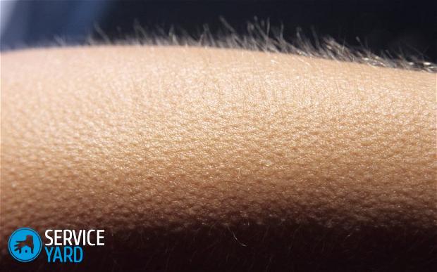 Гусиная кожа на шее ? почему появилась, лечение