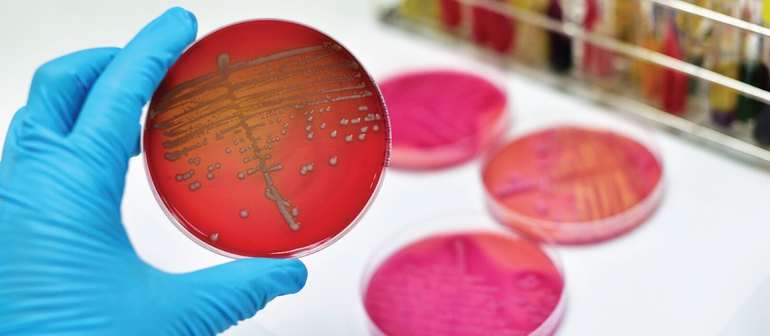 Какие мухи и почему кусаются в конце лета и осенью