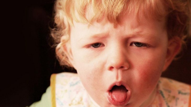 Коклюш у дітей, ускладнення. Симптоми, ознаки, причини та лікування кашлюку у дітей. Профілактика коклюшу