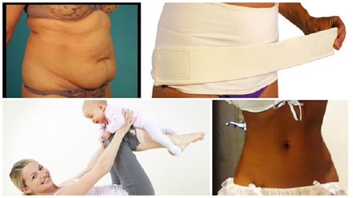 Коли після кесарева розтину і пологів можна дівчині, мамі, що годує качати прес? Вправи на прес після пологів та кесаревого розтину: опис, фото