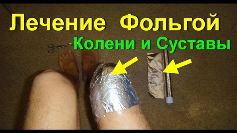 Лікування фольгою суглобів. Як фольгою лікувати спину, кісточку на нозі, артрит і артроз?