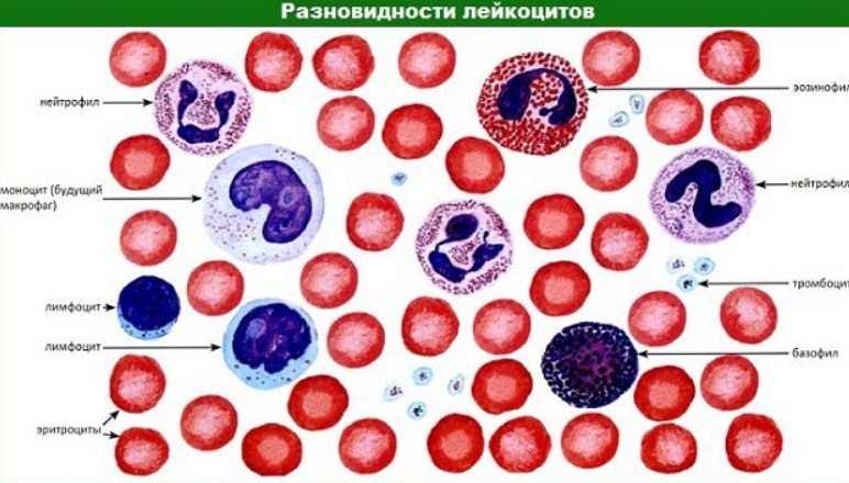 Лейкоцити в крові: види, норма. Підвищений або знижений рівень лейкоцитів у крові: причини — як привести в норму?