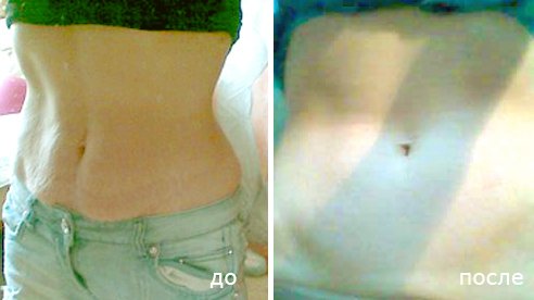 Медовий масаж для схуднення живота: як робити, фото, відео