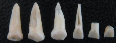 Молочні зуби у дітей: скільки їх і коли випадають?