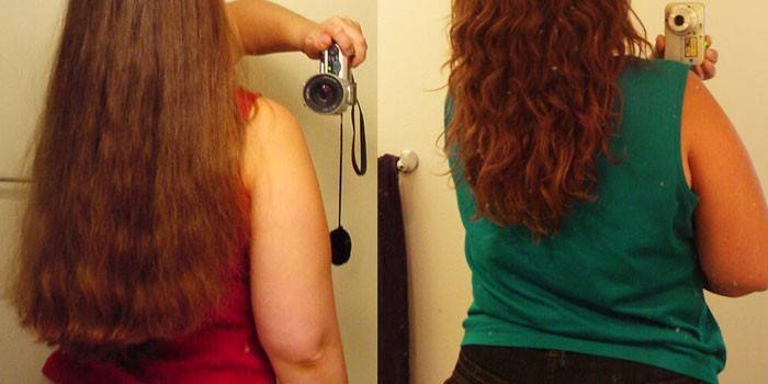 Нікотинова кислота для волосся: застосування та відгуки