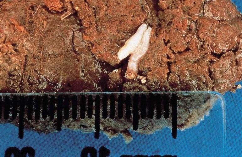 Огуречный цепень у кошек: причины, симптомы и лечение Огуречный цепень у кошек: причины, симптомы и лечение