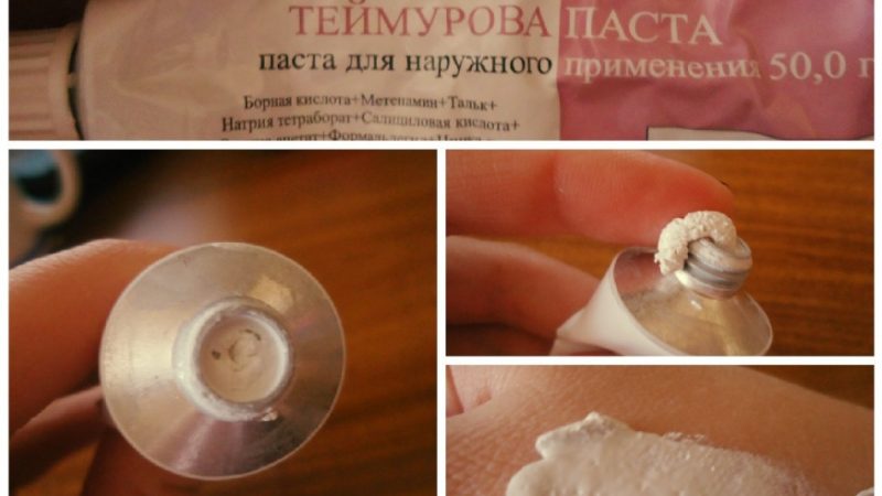 Паста Теймурова – інструкція по застосуванню. Як використовувати пасту і мазь Теймурова від пітливості пахв, запаху ніг і грибка?
