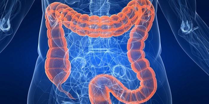 Пневматоз кишечника — симптоми і ознаки. Лікування пневматоза кишечника ліками і народними засобами