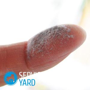 Почему в квартире много пыли?