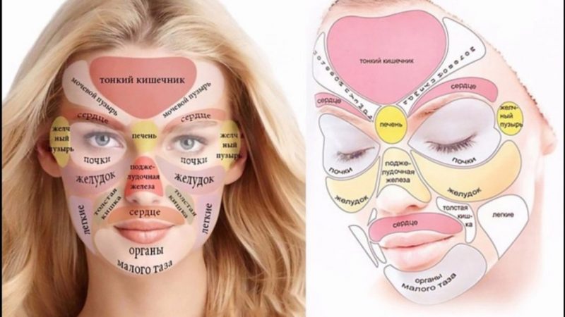 Причини появи вугрів і прищів на обличчі — як позбутися прищів за допомогою масок і мазей: поради дерматолога