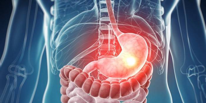 Причини шлункових болів і їх характер — лікування і препарати для знечулення