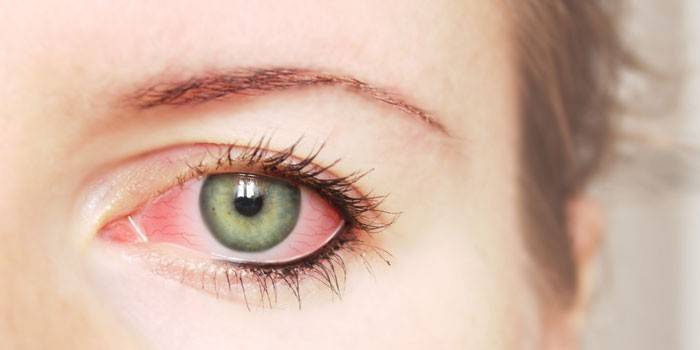 Що робити при гною з ока у дитини і дорослого