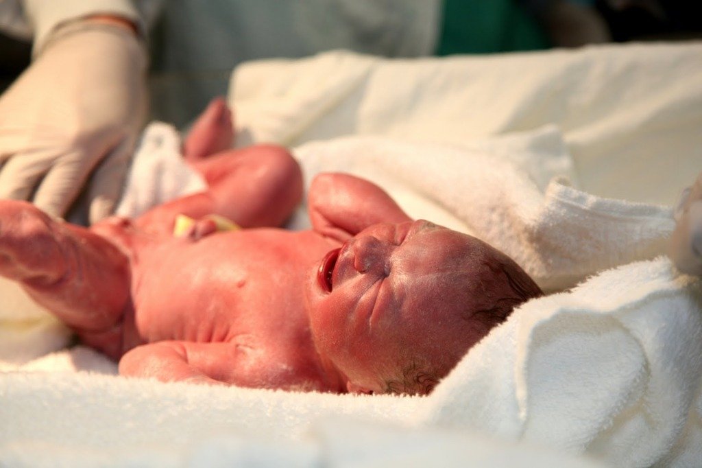 Шкала Апгар: оцінка стану новонародженого, значення 6, 7, 8 і 9 балів Шкала Апгар: оцінка стану новонародженого, значення 6, 7, 8 і 9 балів