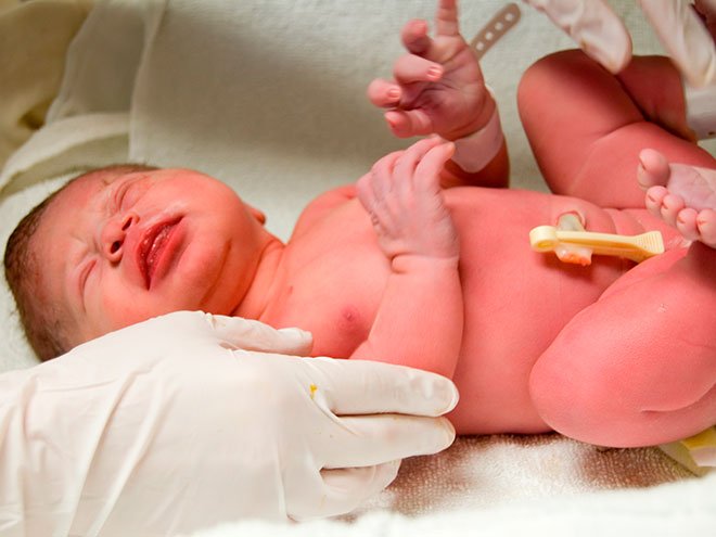 Шкала Апгар: оцінка стану новонародженого, значення 6, 7, 8 і 9 балів Шкала Апгар: оцінка стану новонародженого, значення 6, 7, 8 і 9 балів