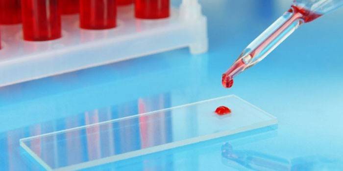 ШОЕ — норма за віком. ШОЕ вище норми — що це значить