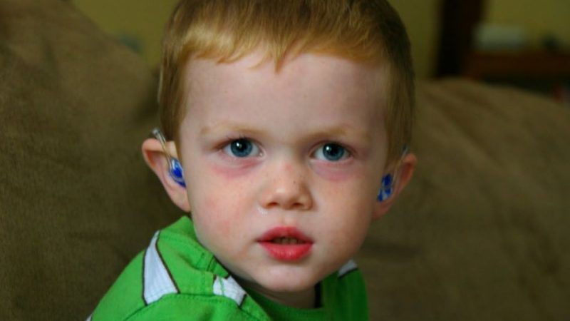 Синці під очима у дитини: причини, що робити? Чому у дитини бліда шкіра і червоні, чорні, фіолетові синці та мішки під очима?