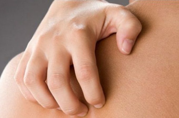 Свербіж шкіри тіла: причини, види, лікування народними засобами і медикаментами, профілактика свербежу