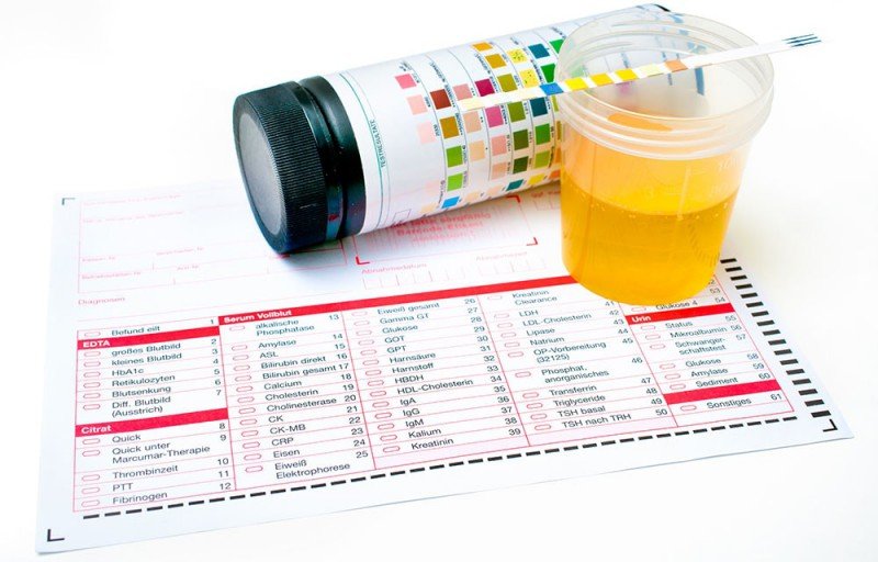 Тест-смужки для визначення наявності ацетону в сечі