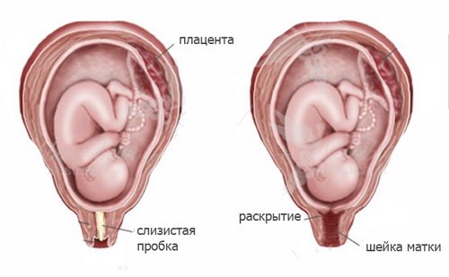 Відходження пробки перед пологами: за скільки днів, як довго відходить, ознаки