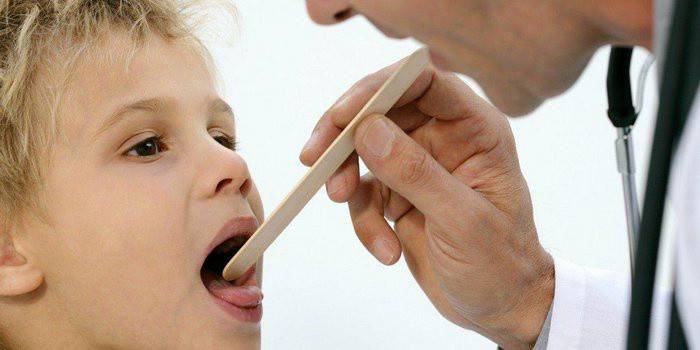 Які антибіотики приймати при ангіні