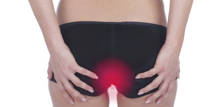 Як лікувати анальну тріщину і які у неї симптоми