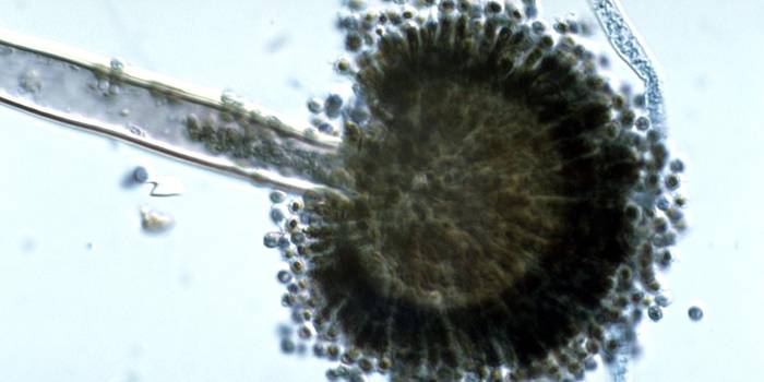 Як позбутися від чорної плісняви на стінах і стелі