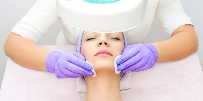 Як позбутися від підшкірних прищів на обличчі швидко