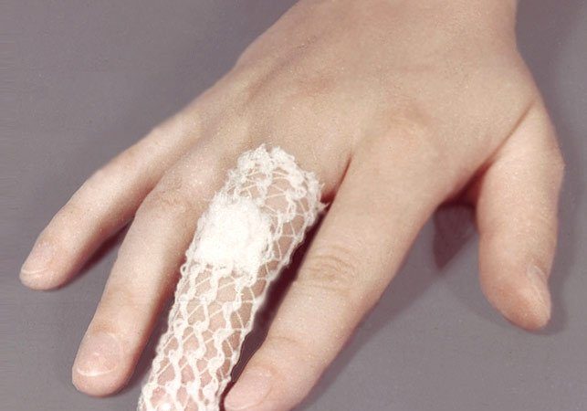 Як прибрати гній з пальця руки або ноги?