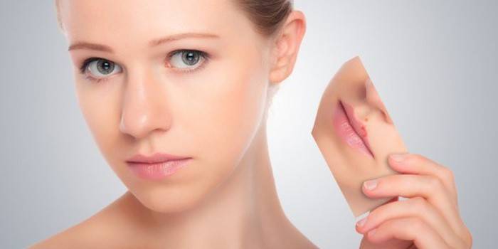 Як вилікувати герпес на губах за 1 день в домашніх умовах