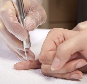 Як вивести бородавки чистотілом самостійно?