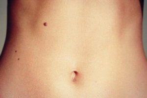 Значення родимок в пупку і поруч з ним для чоловіків і жінок – що такий знак може сказати про людину